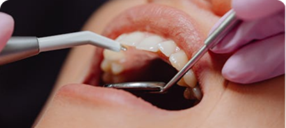Trattamenti endodontici