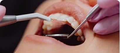 Endodontic treatments