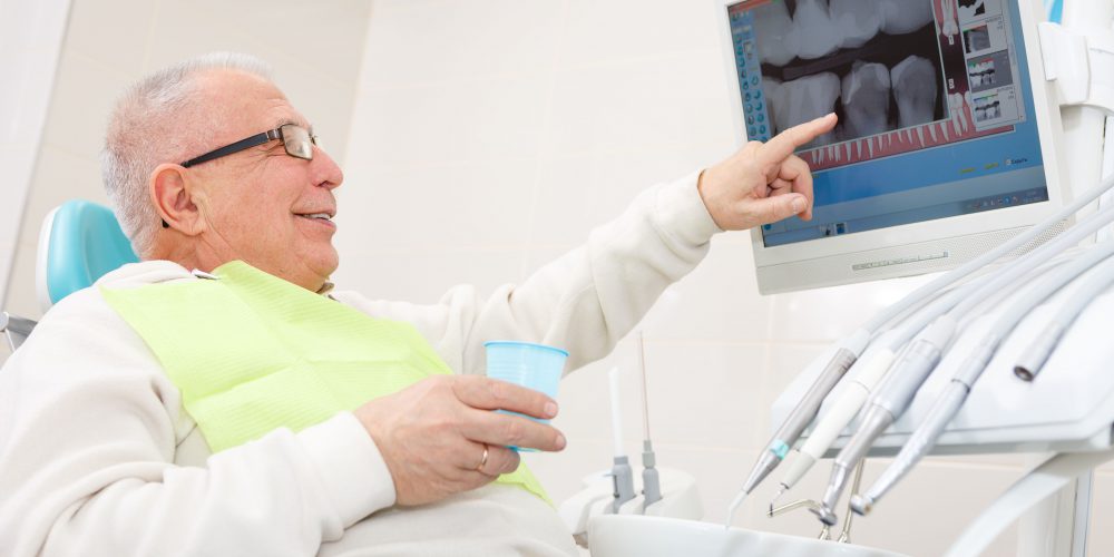 5 myths about dental implants that are not true